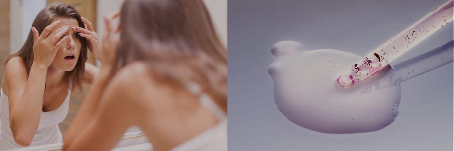 Ny hudpleje = uren hud? Tag det roligt – der findes en forklaring.